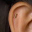 A gold-colored metal rod is inserted into the ear.